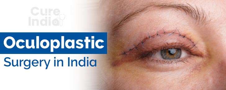 Oculoplastic Surgery